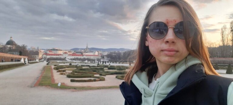 “У мене все обличчя було в ранах, хотілося сховатися від усіх”: як пацієнтка “Неопалимих” вчиться приймати себе нову